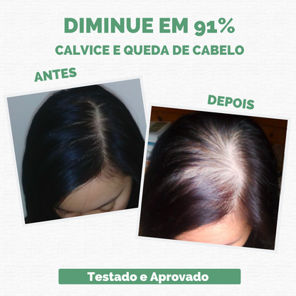 Sérum Repair Hair: Tratamento Revolucionário para Queda de Cabelo