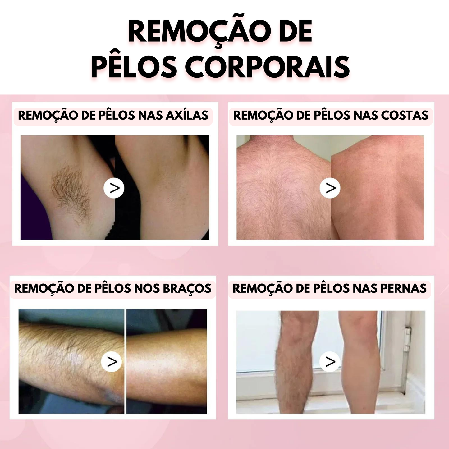 Spray de Remoção de Pelos em Mousse