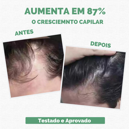 Sérum Repair Hair: Tratamento Revolucionário para Queda de Cabelo