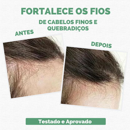 Sérum Repair Hair: Tratamento Revolucionário para Queda de Cabelo