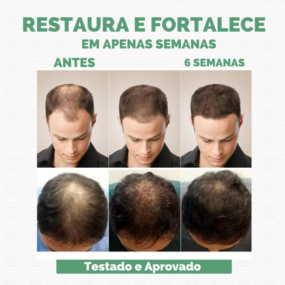 Sérum Repair Hair: Tratamento Revolucionário para Queda de Cabelo